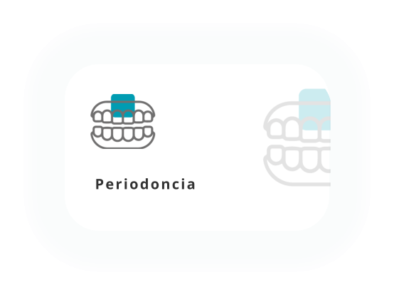 Banqueamiento Dental Boadilla del Monte