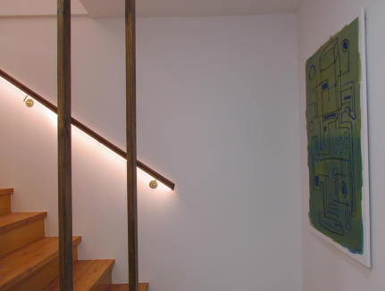 Banqueamiento Dental en Boadilla del Monte